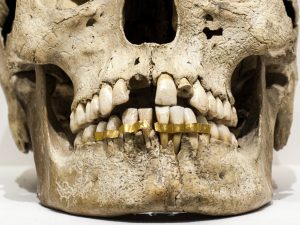 historia de la ortodoncia en la Edad Antigua